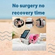 ​Laser Body Sculpting